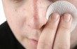 man skin treatment