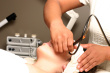 derma laser