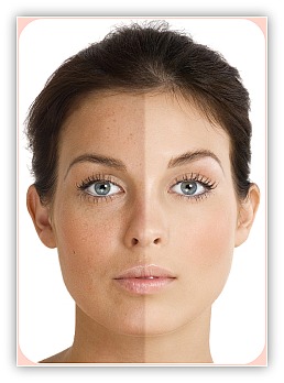 http://www.skincareresourcecenter.com/image-files/sun-damaged-skin.jpg