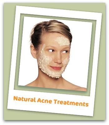 Acne Natural Treatment