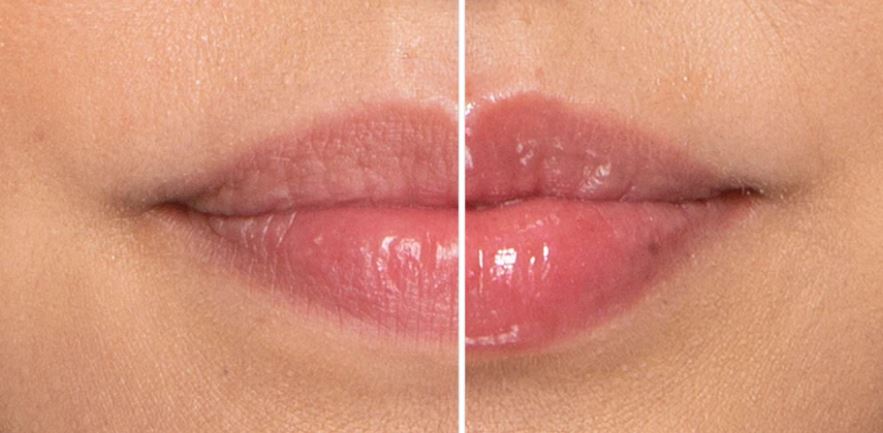 Effective Lip Plumpers