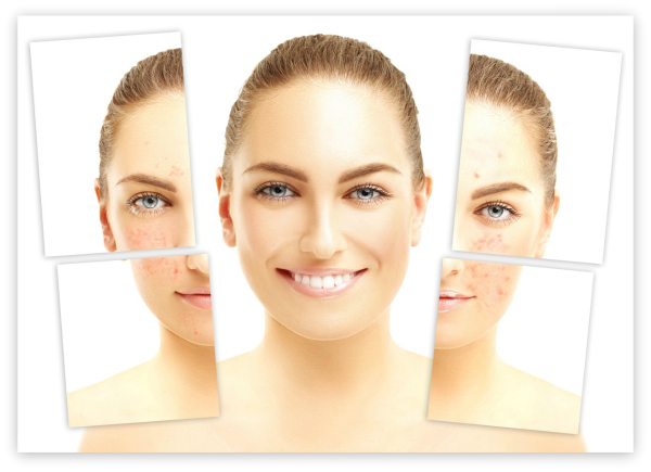 bha-treatments bha-treatments