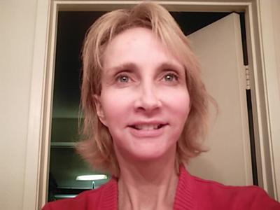 Get Rid of Age Spots on Fair Skin - I just had a 30 percent TCA