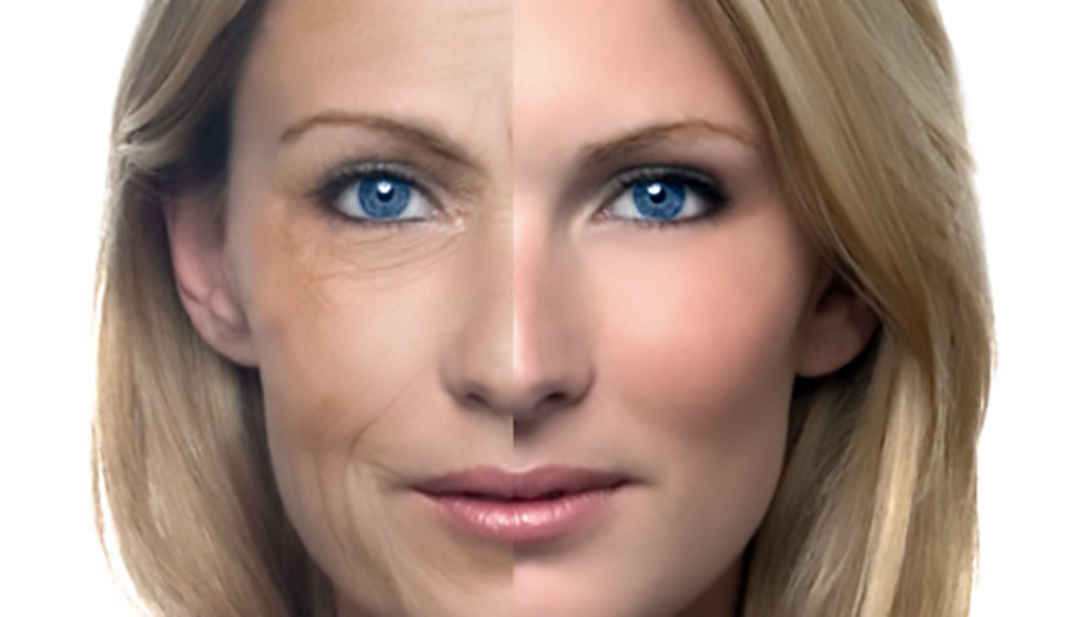 tretinoin-information