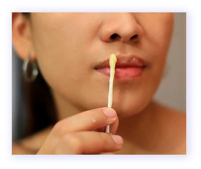 Treatments for Dark Skin Around Lips