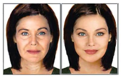 It's Like a Mini Face Lift!