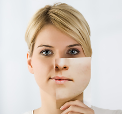 Effectively Treating Menopause Skin Symptoms menopause-skin