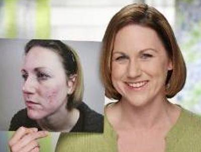 Peter Thomas Roth Serum