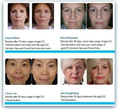 Before and After Galvanic Spa Treatments