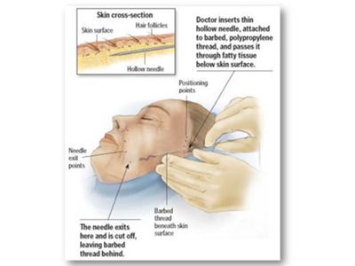 Lifestyle Lift Step #1